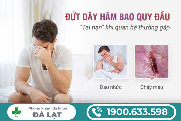 Hình ảnh minh họa